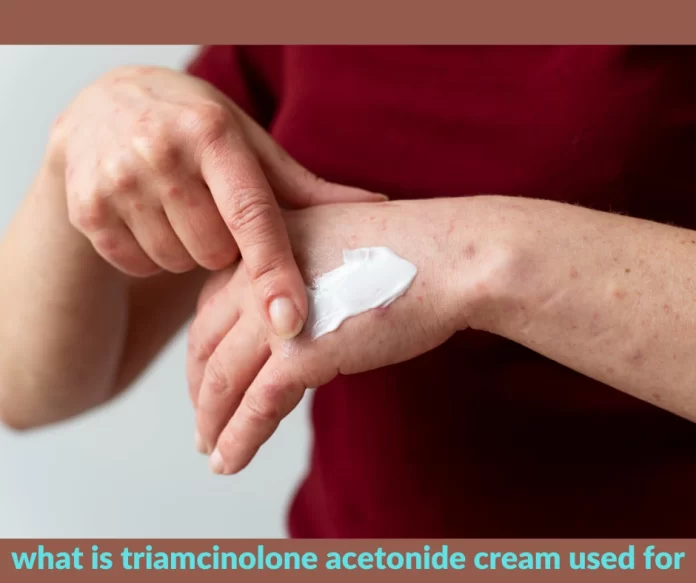 what is triamcinolone acetonide cream used for